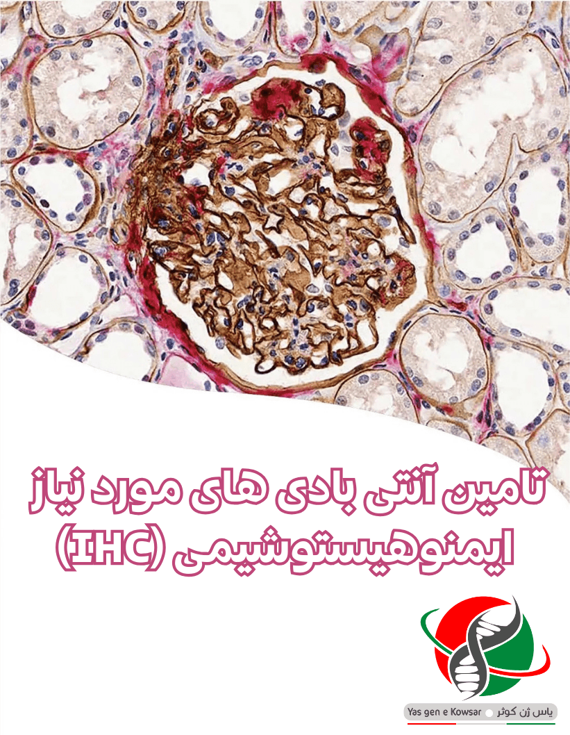 تامین انتی بادی های IHC در ایران شرکت یاس ژن