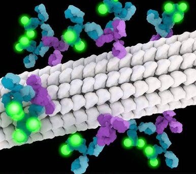تامین انتی بادی های IF در ایران شرکت یاس ژن