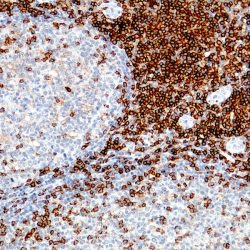تامین انتی بادی های IHC در ایران شرکت یاس ژن