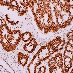 تامین انتی بادی های IHC در ایران شرکت یاس ژن